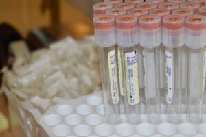 Close up of test tubes sticking out of a box.